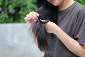 ksp-post pregnancy- changes in hair