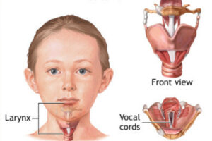 tips to prevent vocal abuse